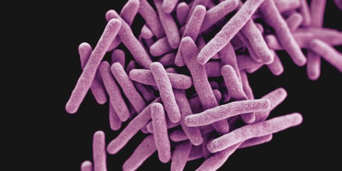 WHO meldet leichte Verbesserung im Kampf gegen Tuberkulose